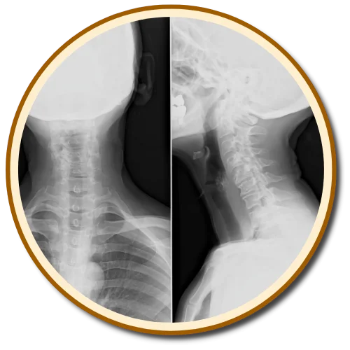 Gonstead X-rays Pantego